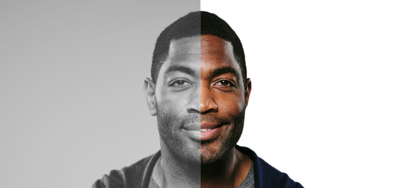 Photo illustration of man's face split in two: one side in paralysis and the other side smiling