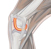 Illustration of Knee cartilage